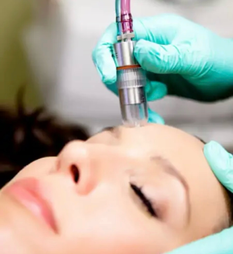 Crystal Microdermabrasion