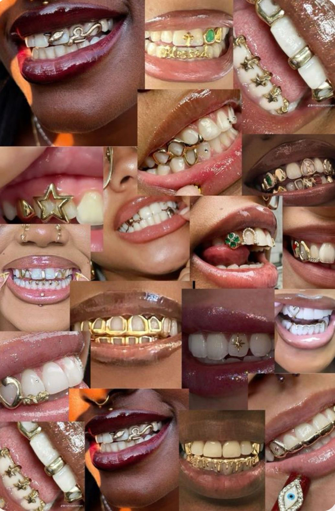 Custom  Gold Grillz