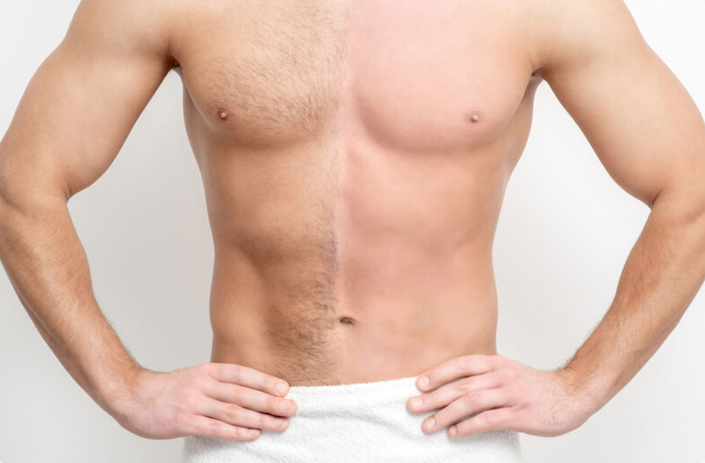 Full Abdomen Wax