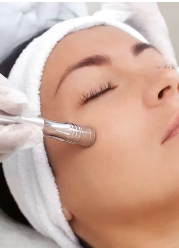 Facial Con Microdermabracion