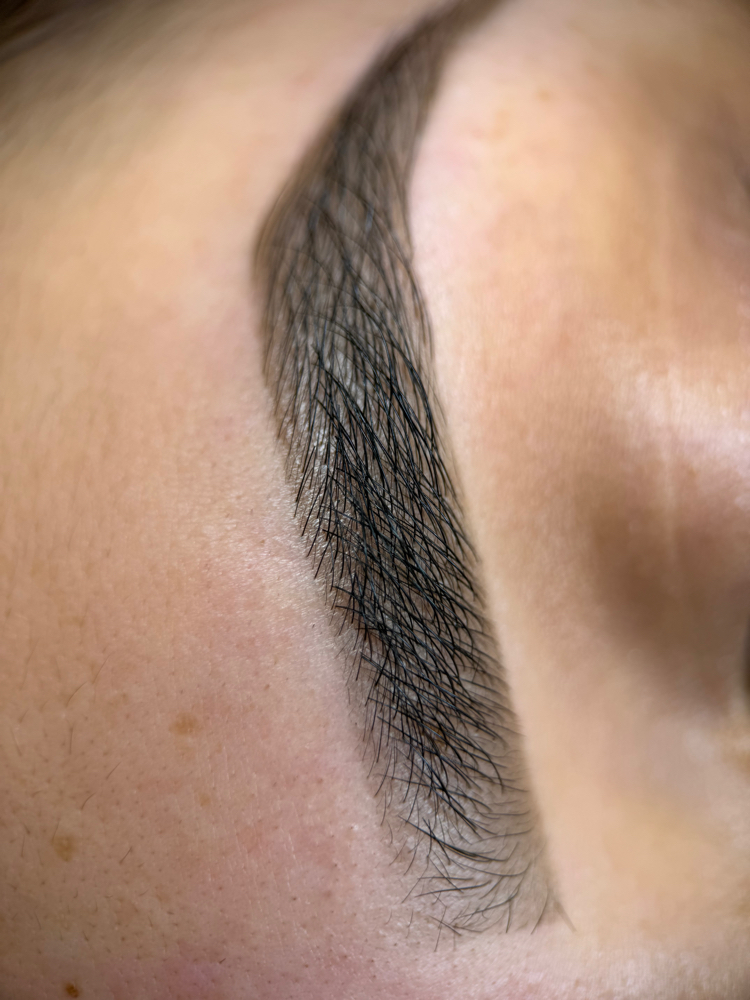 Eyebrow Reconstroction