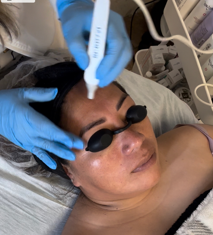 Hydrafacial