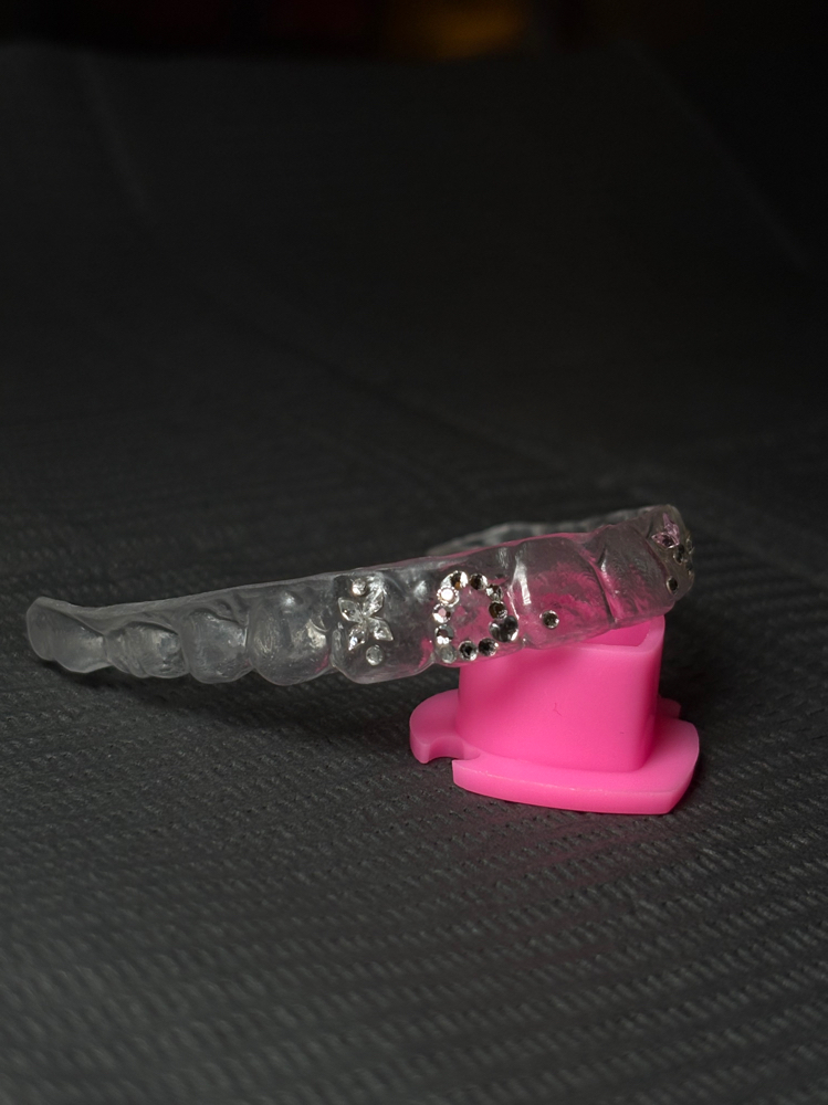 Tooth Gem Retainers