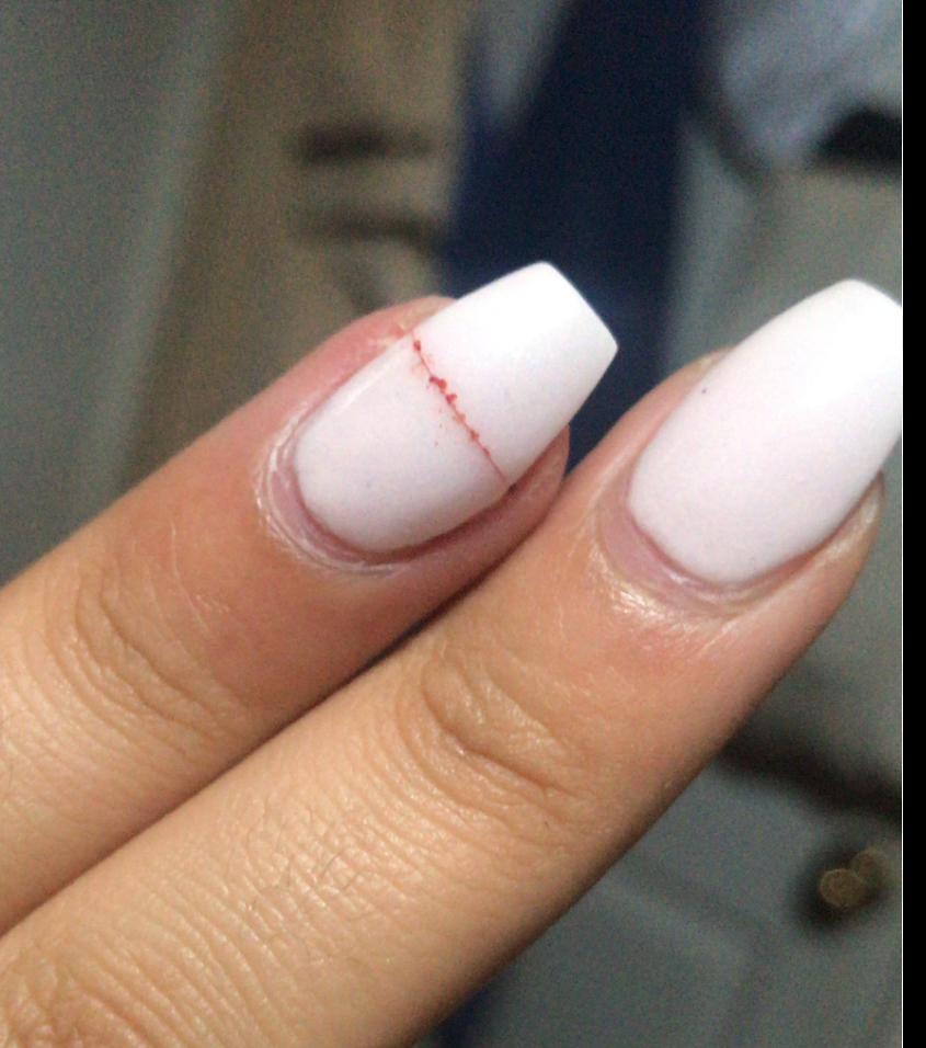 Nail Repair