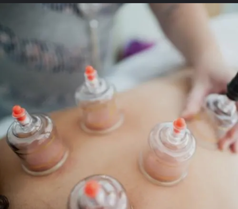 Cupping