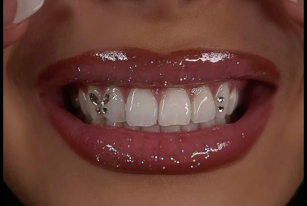 Tooth Gems (Service Coming Soon)