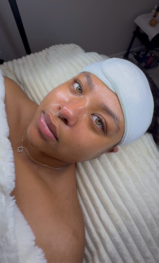 Perfection Chemical Peel
