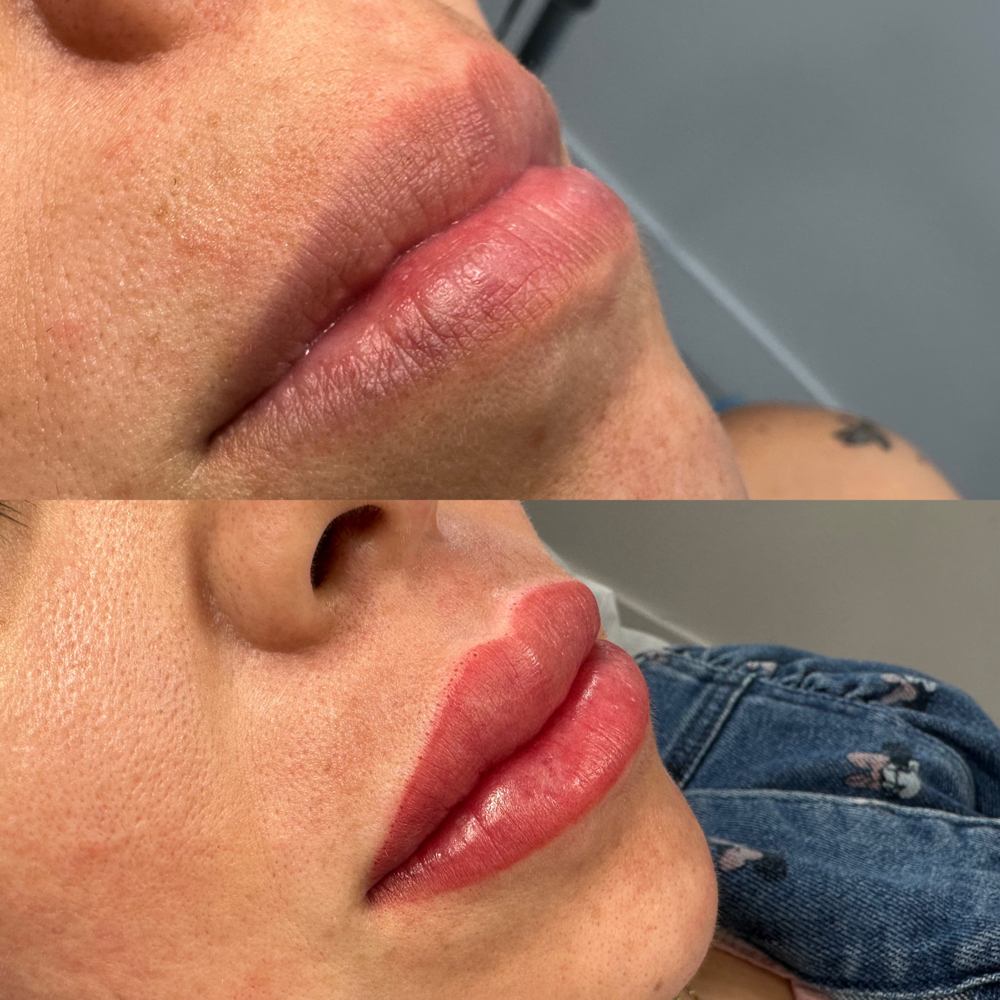 Permanent Makeup - Lip Blush