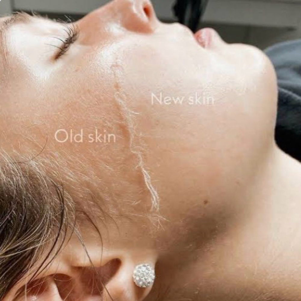 Dermaplane-PRO®️ Add-On at Ethereal Esthetics in Waialua, HI
