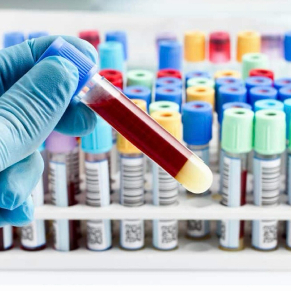 Cash Pay Lab Services at Revived Wellness & Aesthetics in Quincy, IL