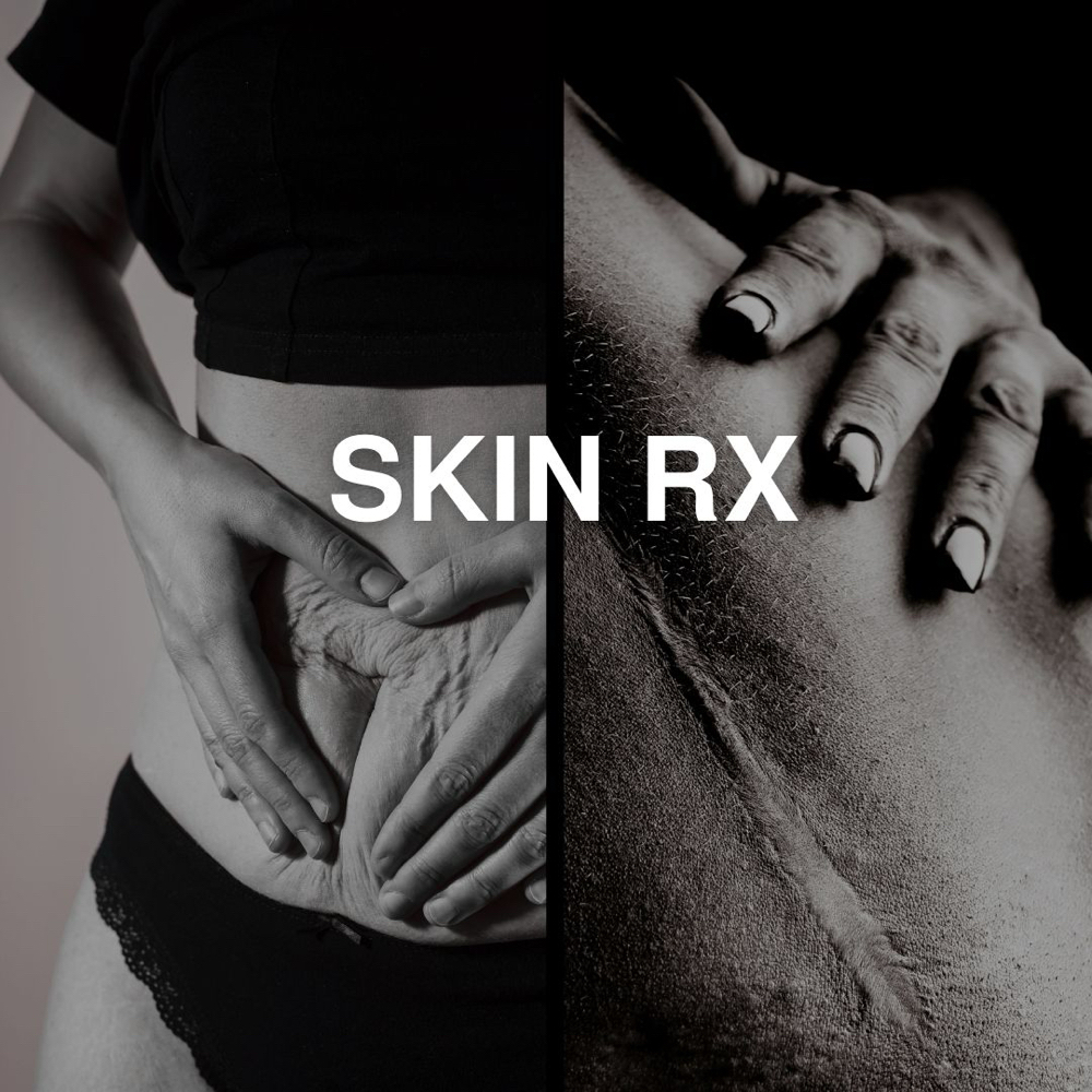 SkinRX at Tight Club | DSM in Des Moines, IA