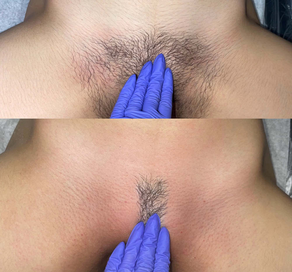 THE LANDING [UNISEX]™