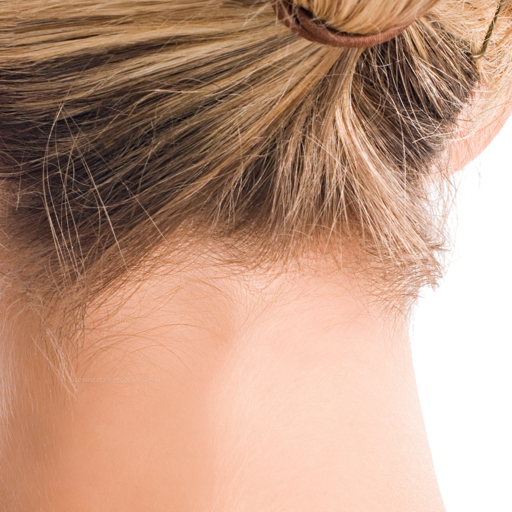 Hairline/Back of Neck