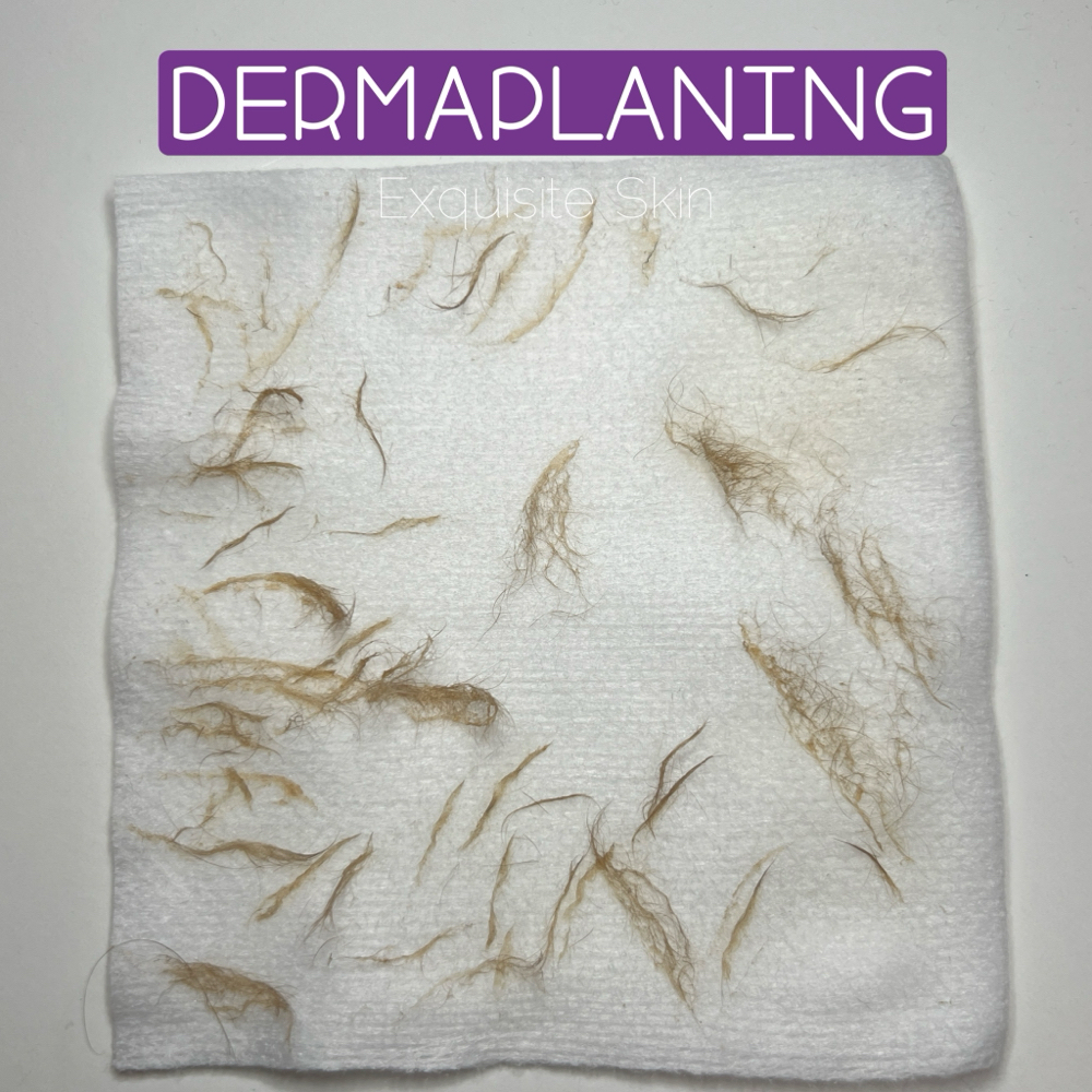 Dermaplaning