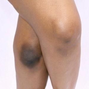 Knees / Rodillas at LUXOR BEAUTY BAR in ALPHARETTA, GA