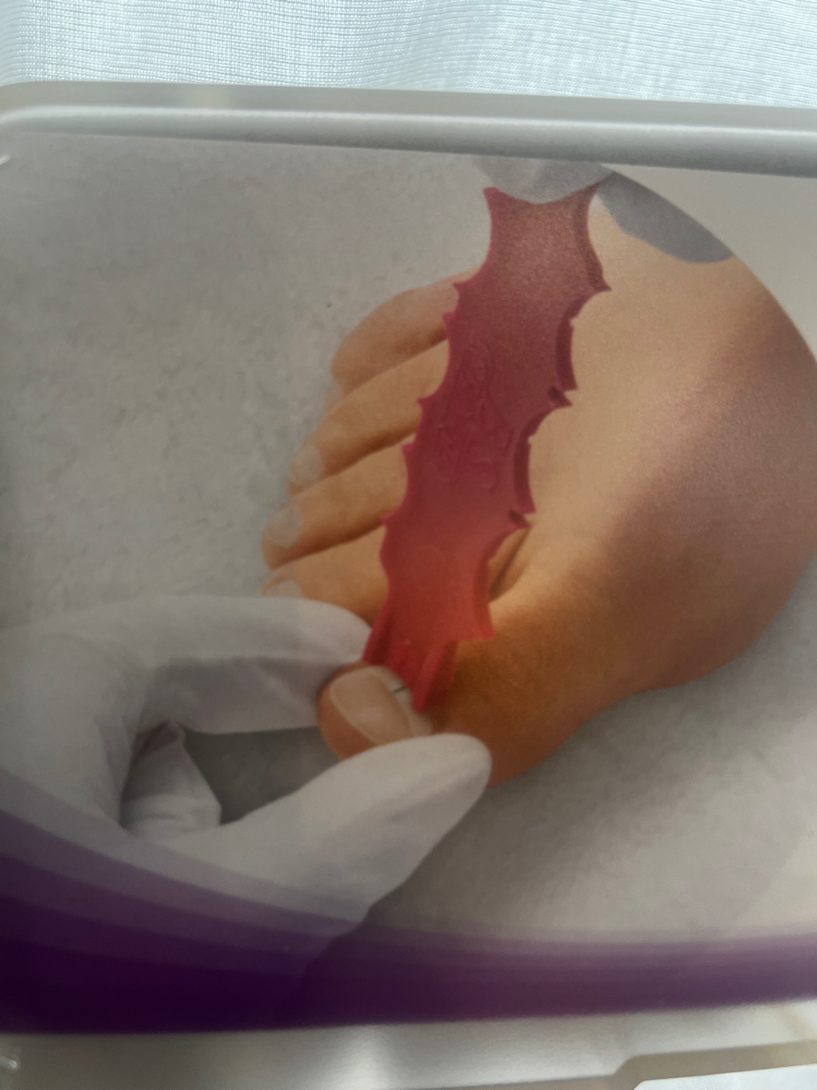 Nail Brace