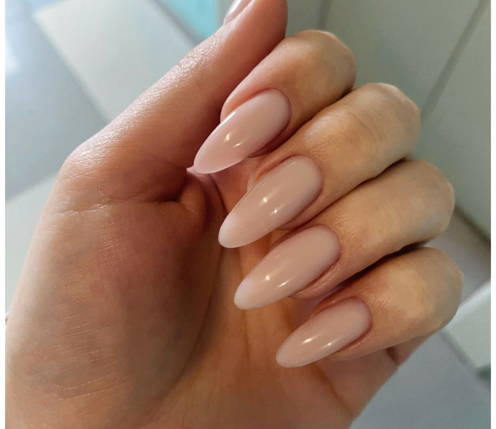 Structure Gel Overlay