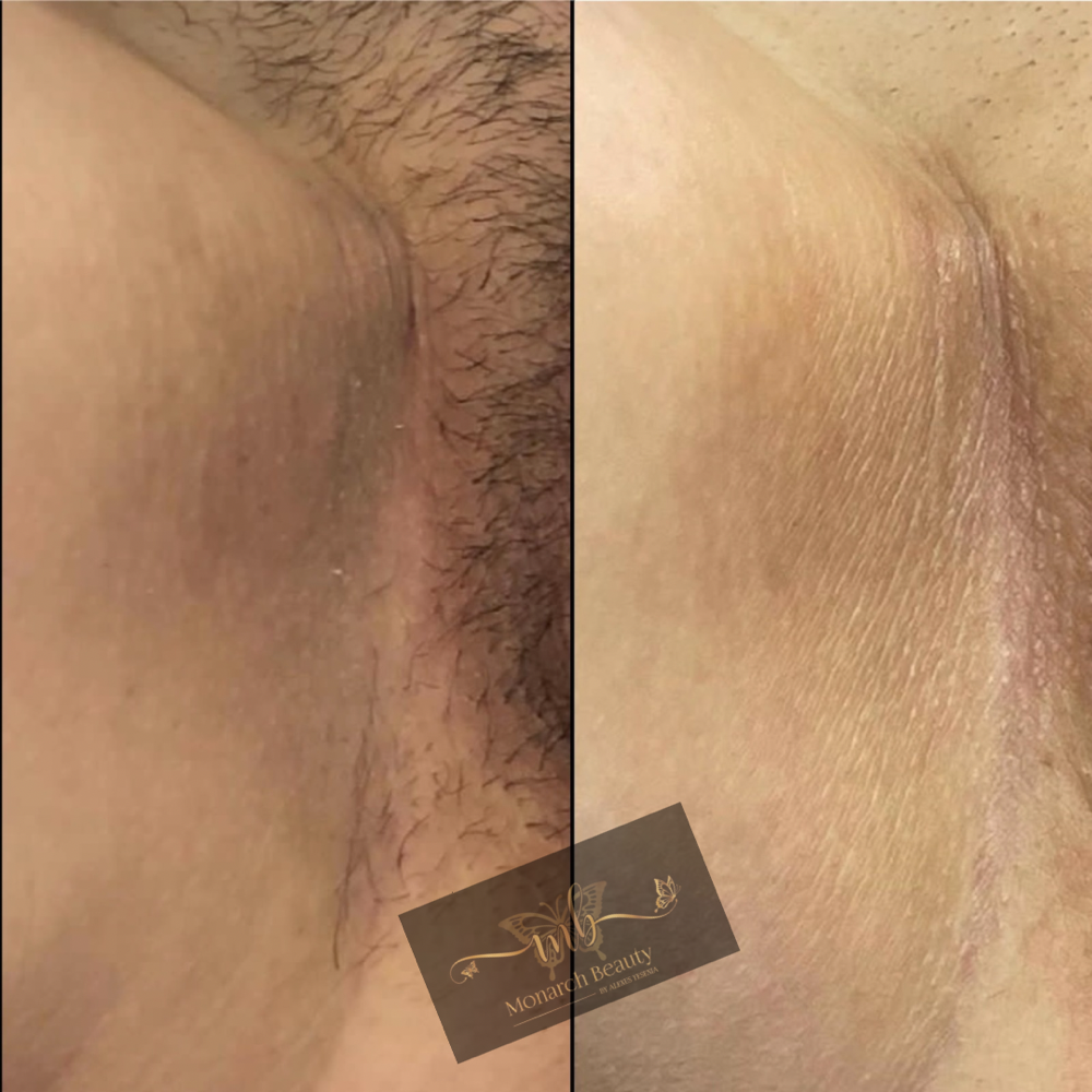 Anal Package 3 intimate Lightening