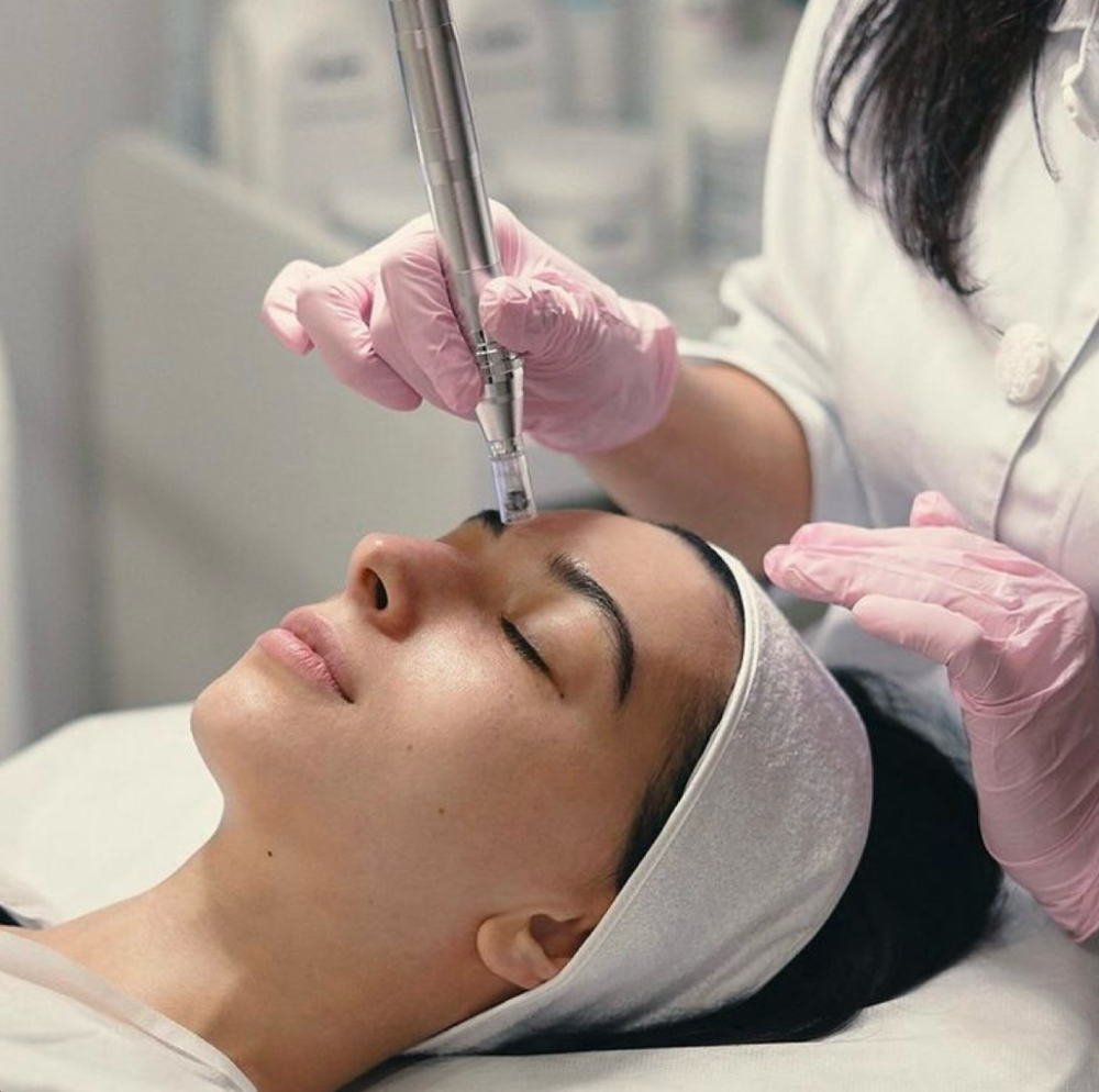 ‘Just’ Microneedling