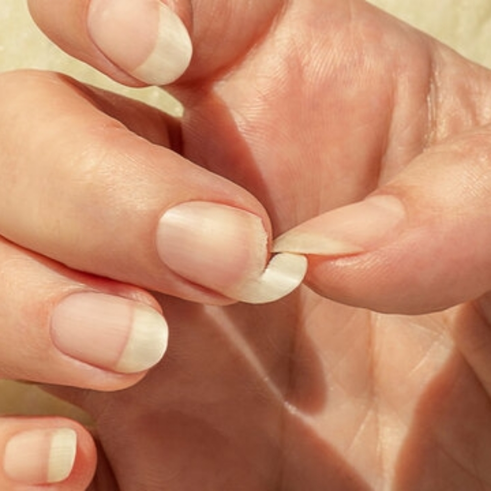 NAIL EMERGENCY! at Nails by Sara in Visalia, CA