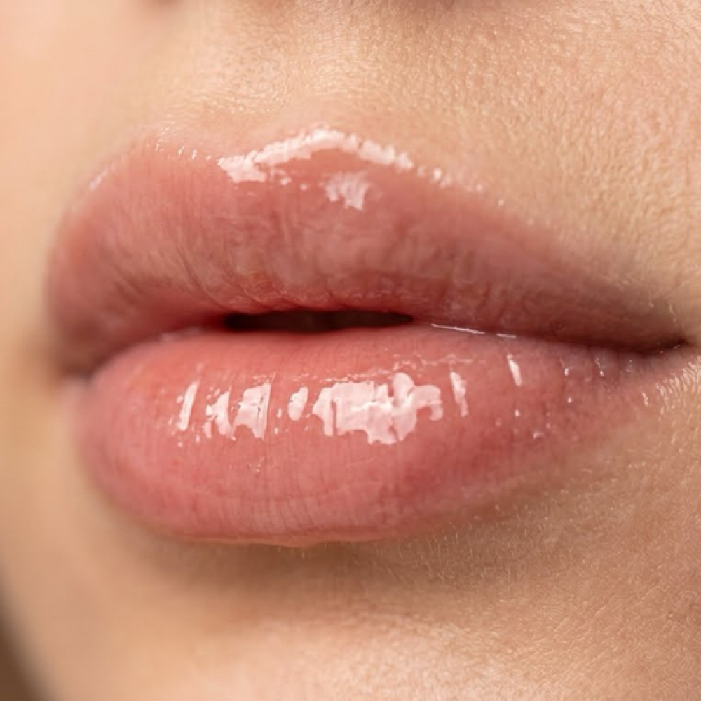 HYDRALIPS at E&E Esthetics in Fort Lupton, CO