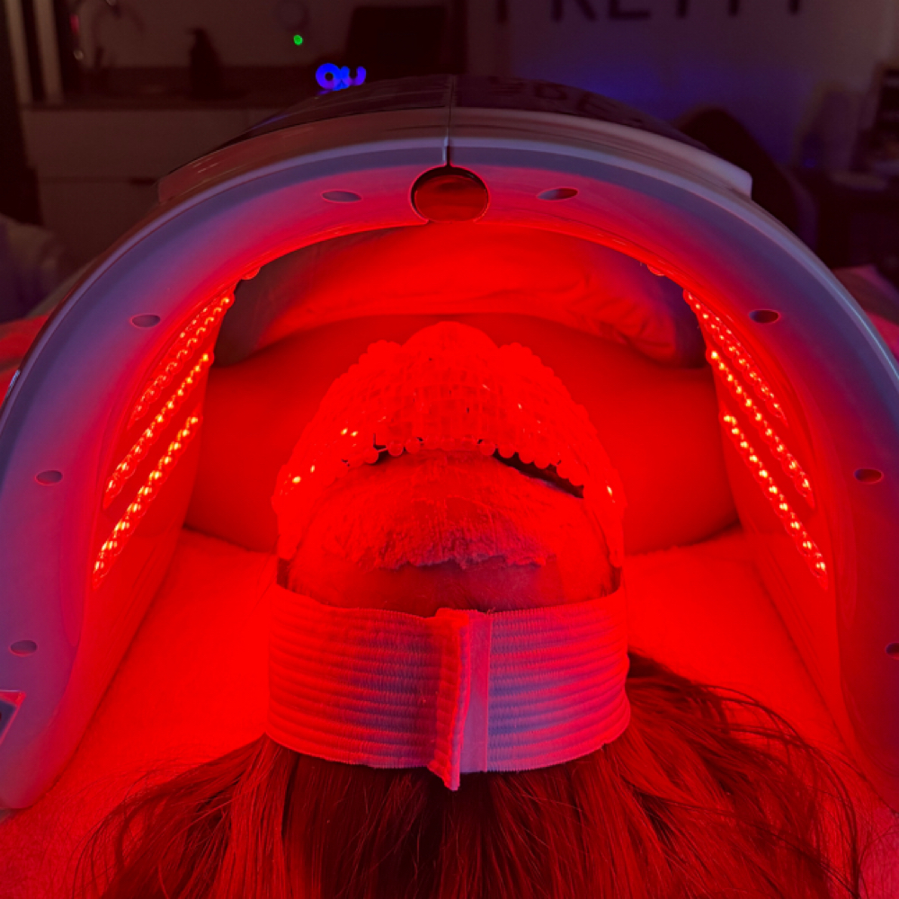 Advanced Skin Renewal Facial at KW Aesthetics in Sharon, MA