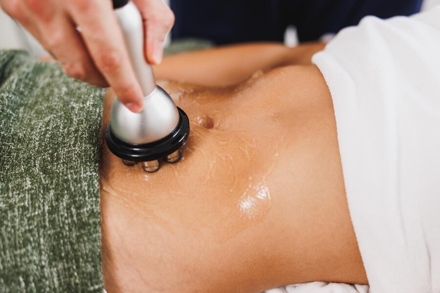 Cavitation (1 Session)