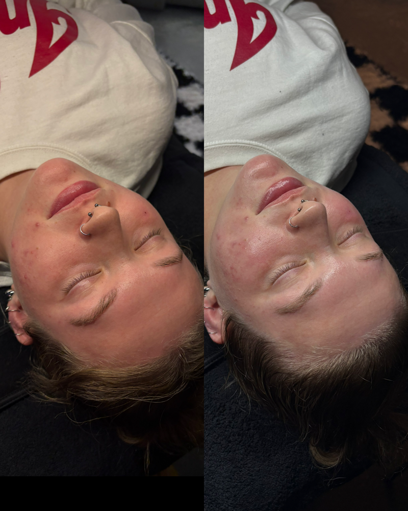 Radiant Reset Facial