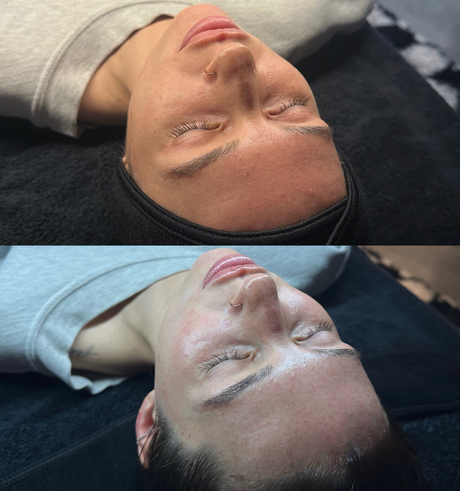 Radiant Reset Facial