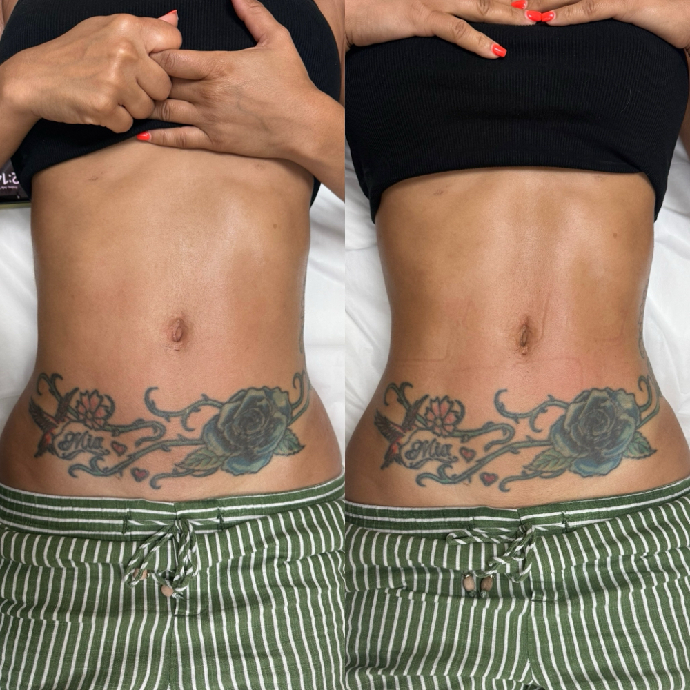 Body Contour Boost