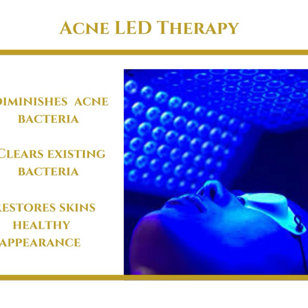 LED Acne Deluxe Treatment at Journey Skin Co. @ The Hair Factory in Lyndhurst, NJ