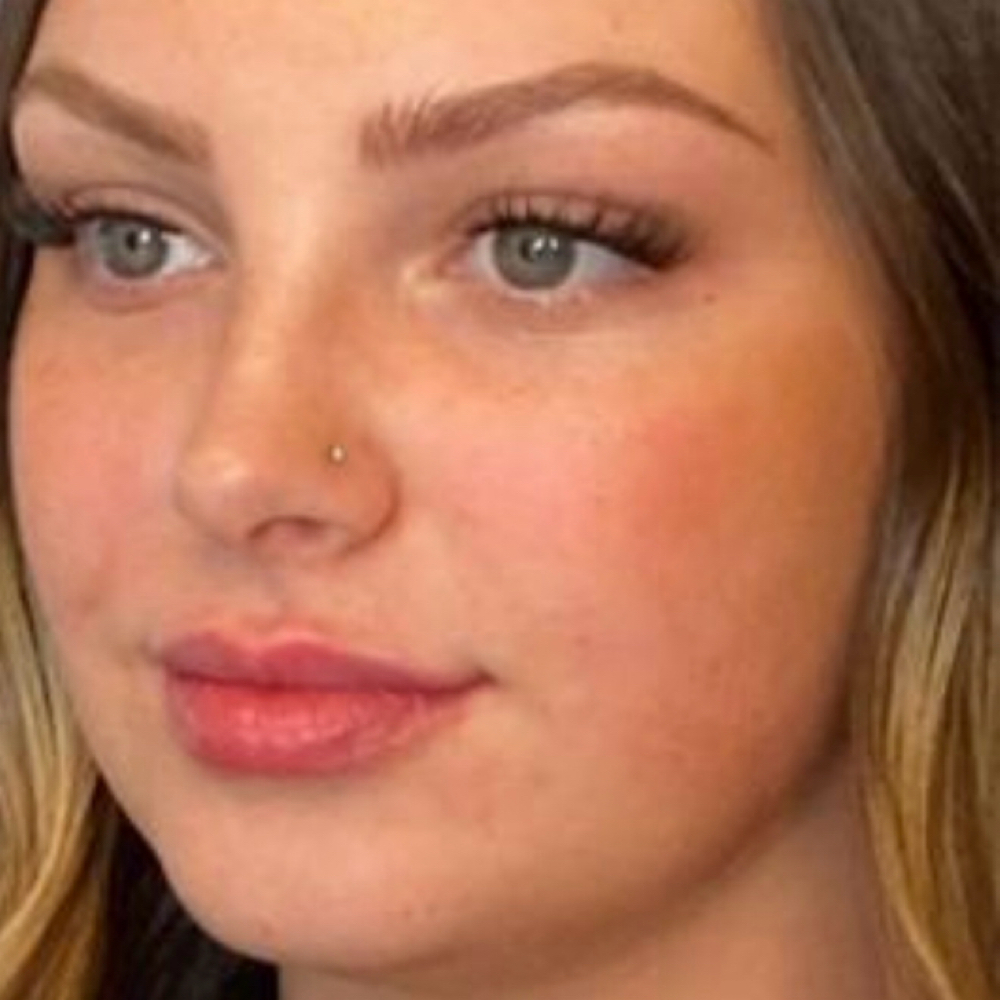 Radiant Lip Sculpt at Redeemed Radiance Aesthetics & Cosmetic Injections in San Antonio, TX