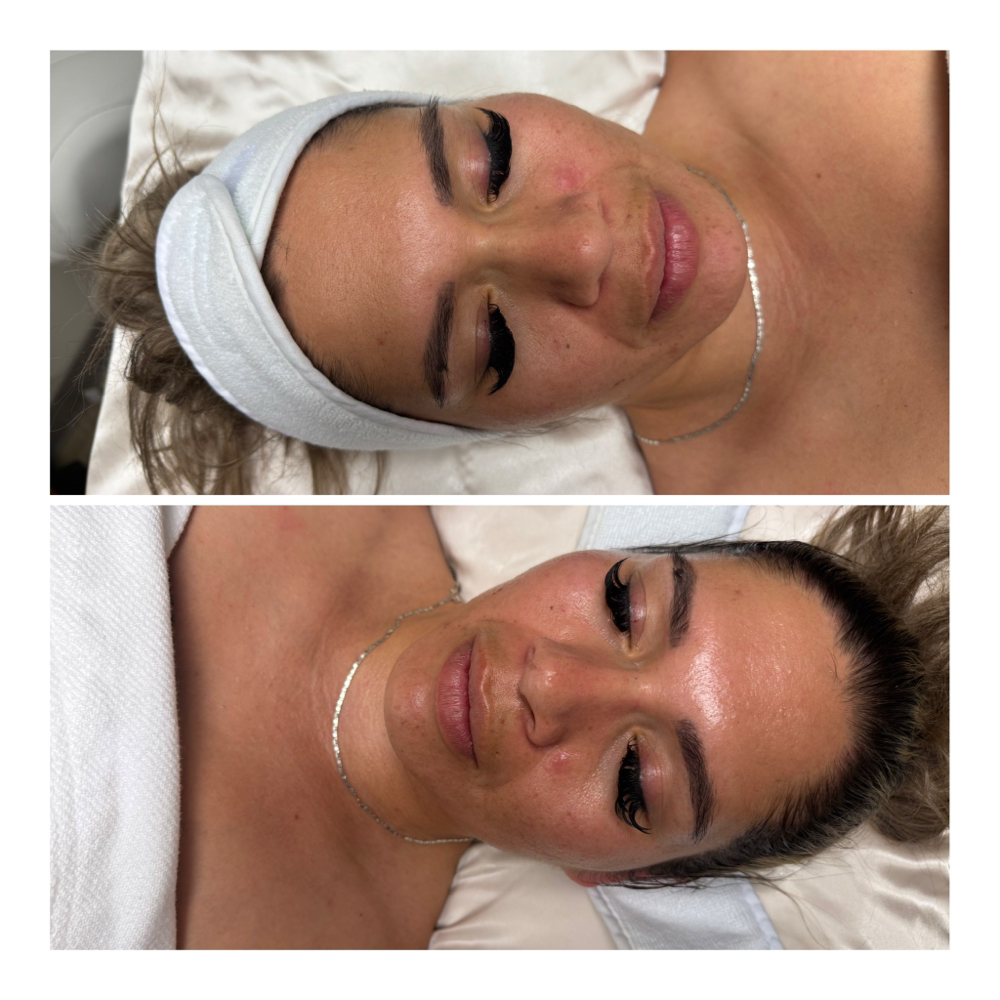 Basic Customized Facial