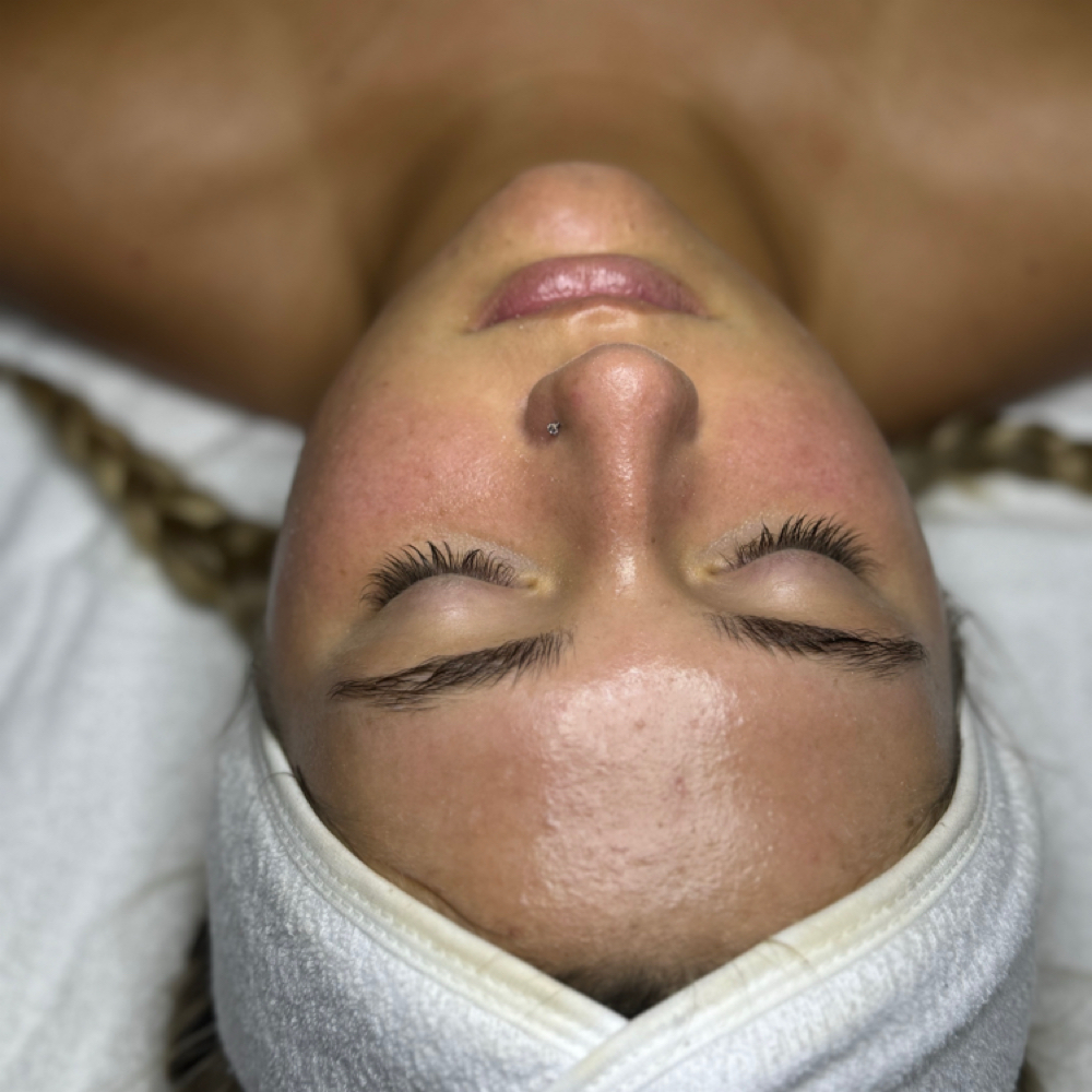 Hydro-Facial at Bare Skin Aesthetics in West Palm Beach, FL