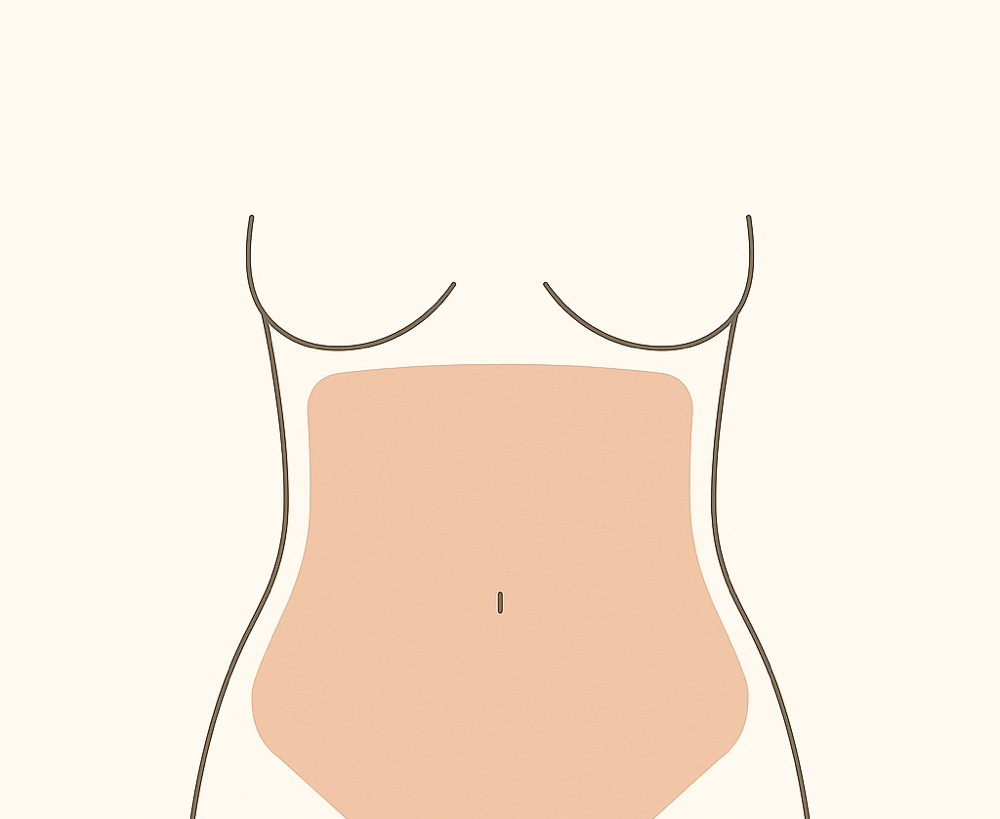 Stomach Full at BareSkinAesthetics in Ridgeland, MS