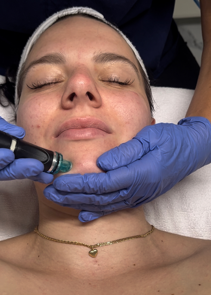 Signature HydraBeauty Facial