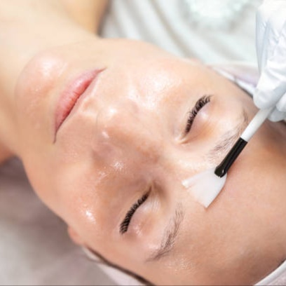 Glycolic Peel at Brow Envy By Ruchi in Burlingame, CA