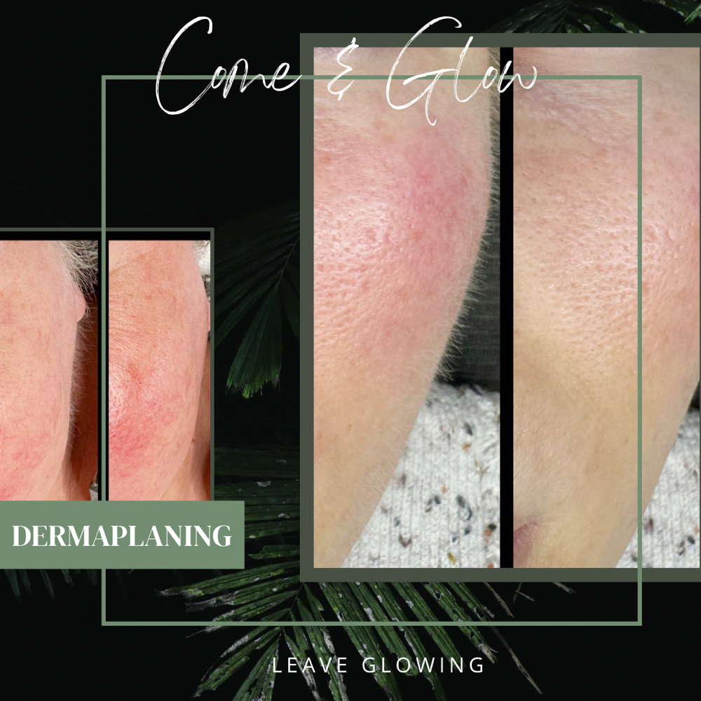 Come & Glow (Dermaplaning & Mask)