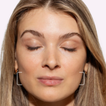 Masseter Tox Treatment at Injections by Leighanna in Clarksville, IN