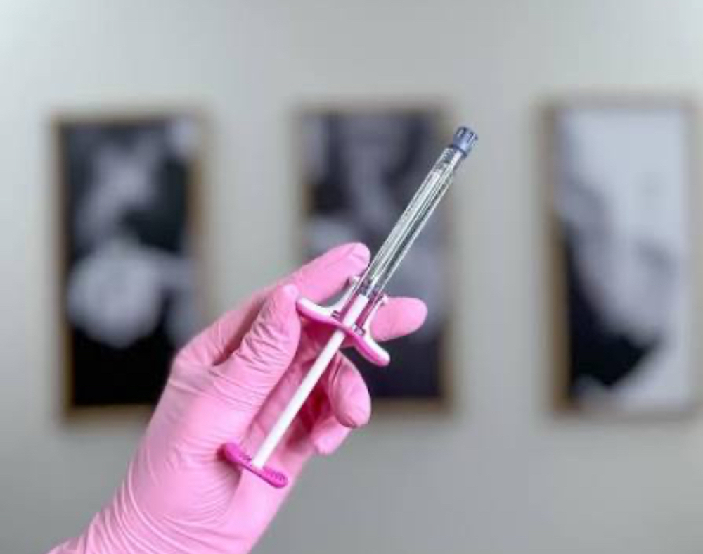 Nasolabial Filler (Smile Line)