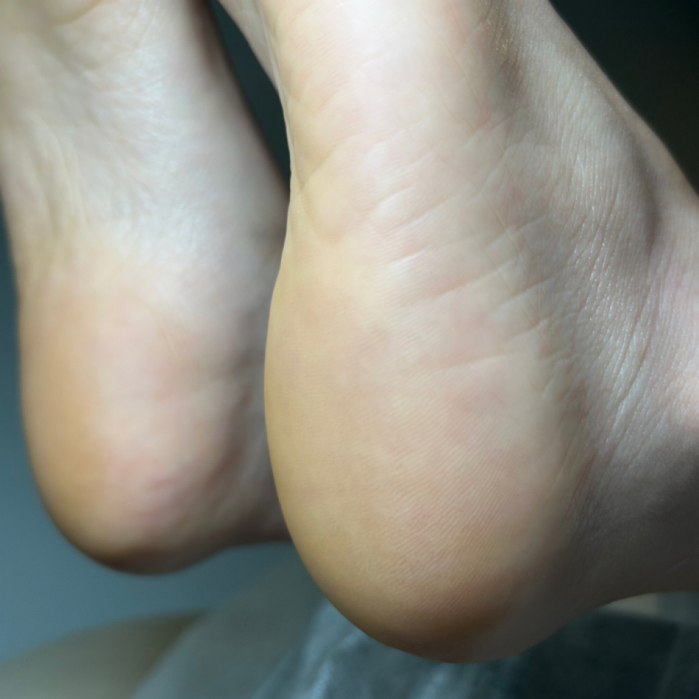 Callus Removal (no Toenails) at Jane&Beauty nail studio in Maple Grove, MN