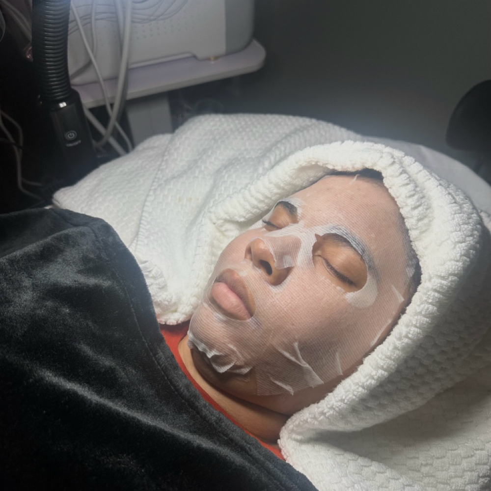 Medical-grade Chemical Peel at T&N Skin Med Spa Inc in Abington, PA