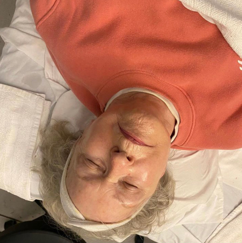 Fountain of Youth Facial