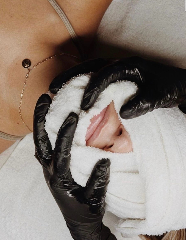 Chemical Peel treatment