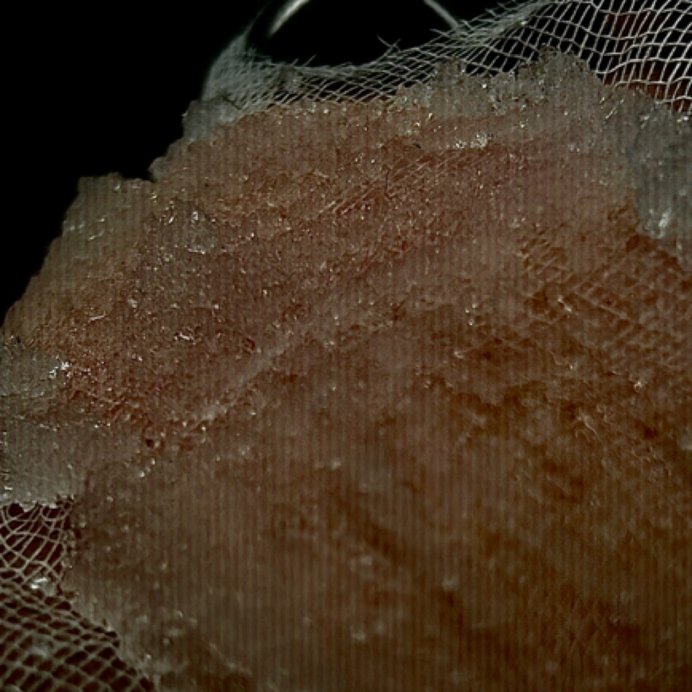 ICE INFUSION FACIAL at MySkin Aesthetics in Laredo, TX