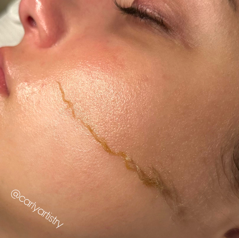 Dermaplaning Facial