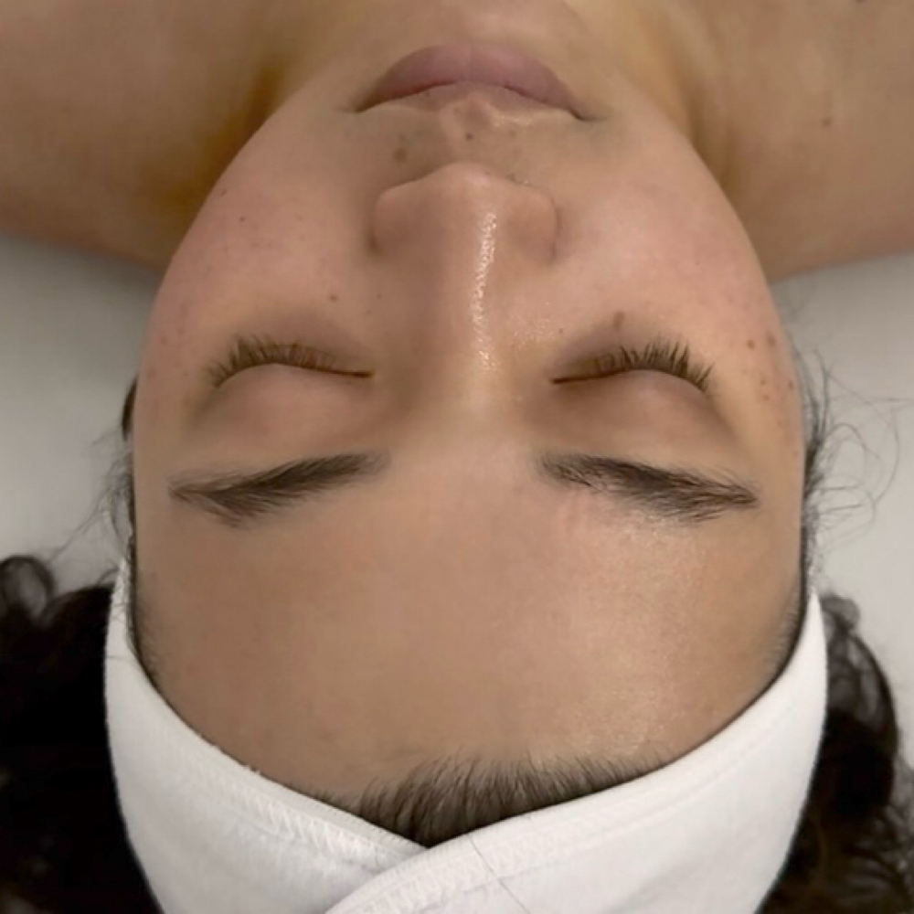 Dermaplaning at EstheticallyMei LLC in Lansing, MI