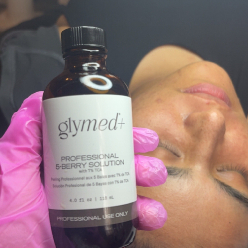Chemical Peel at ARock Beauty & Wellness in San Angelo, TX
