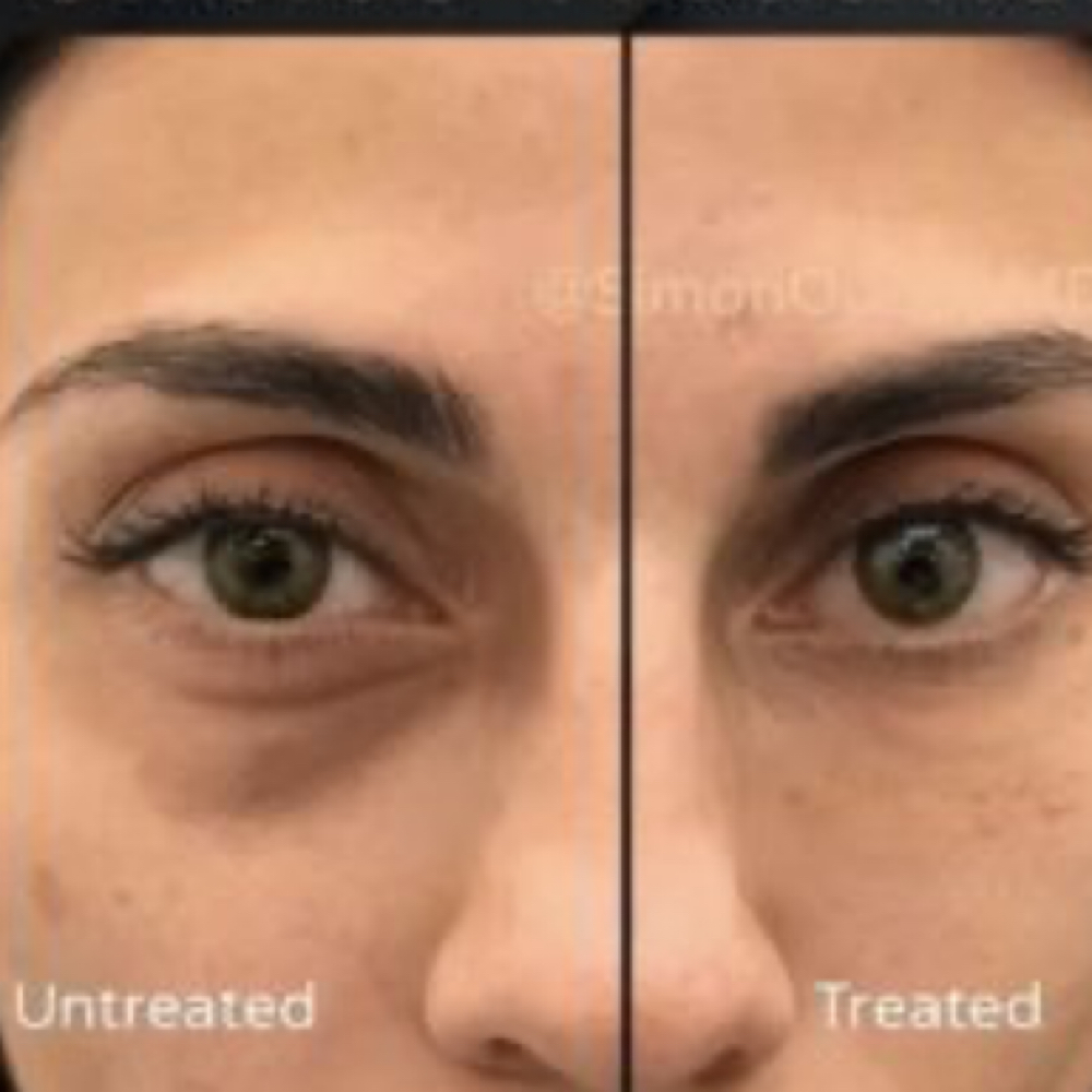 Dark Under Eye Camouflage at Divine Beauty Design LLC in Christiansburg, VA