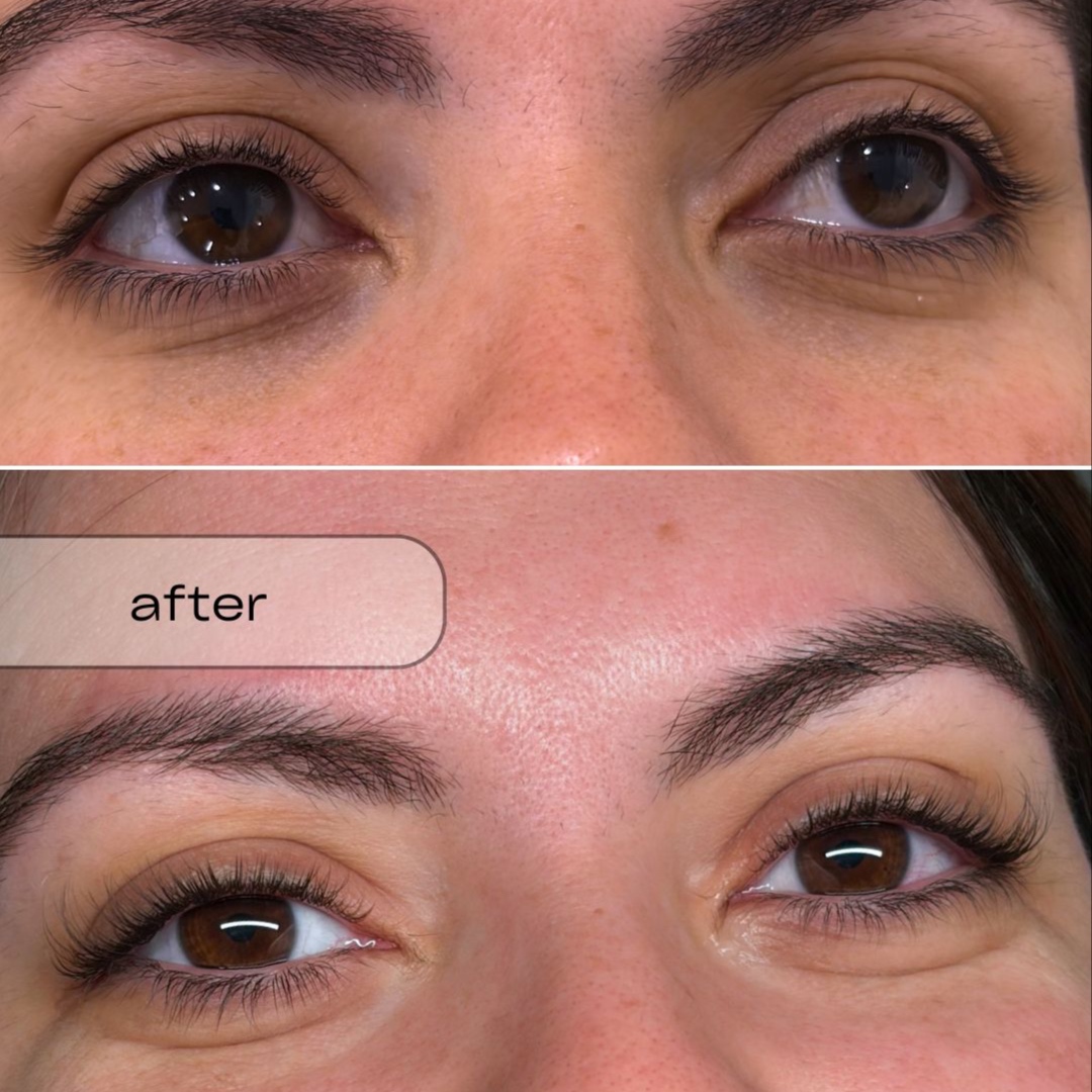 Lash Lift + Half-Set Extensions at Verser Beauty Studio